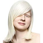 Общество людей с альбинизмом