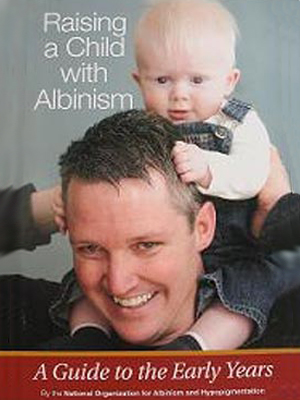 Как растить ребенка с альбинизмом. Книга родителям